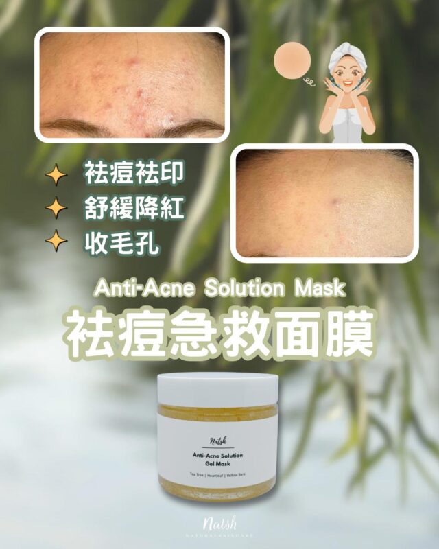 抗痘面膜Anti-acne Mask
